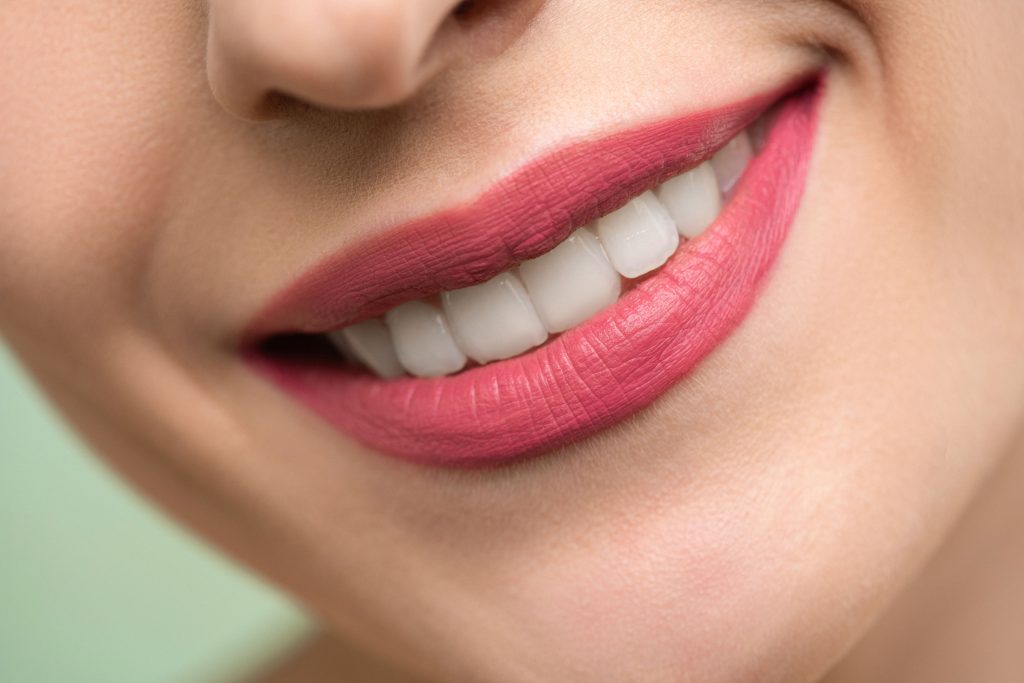 Close-up of a woman's smile, showing bright, white teeth