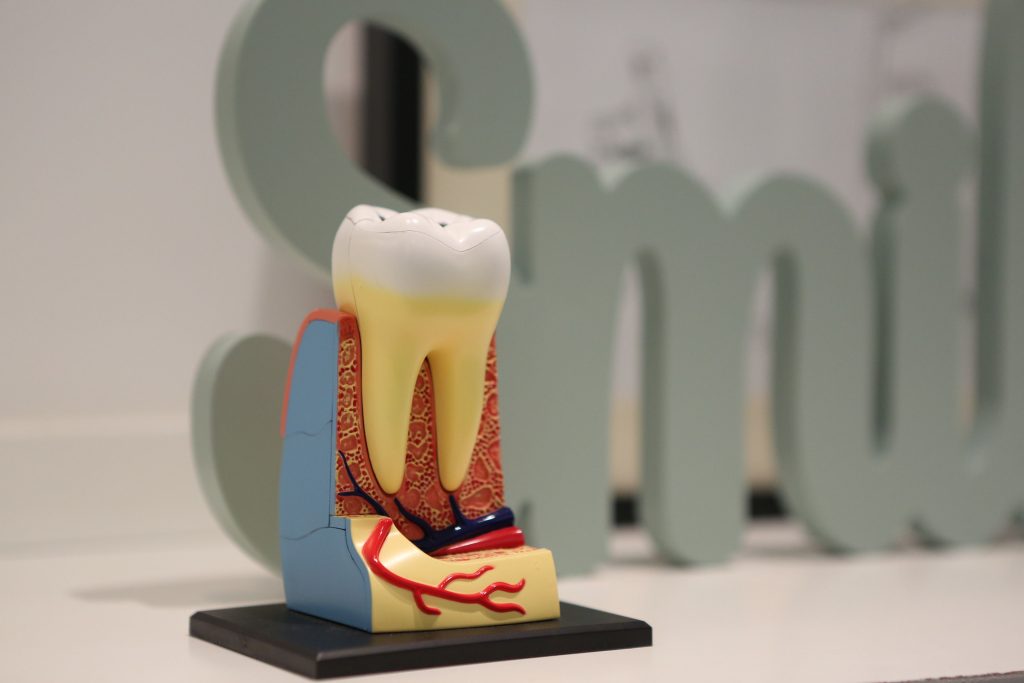 Dental model of a tooth showing the crown and roots