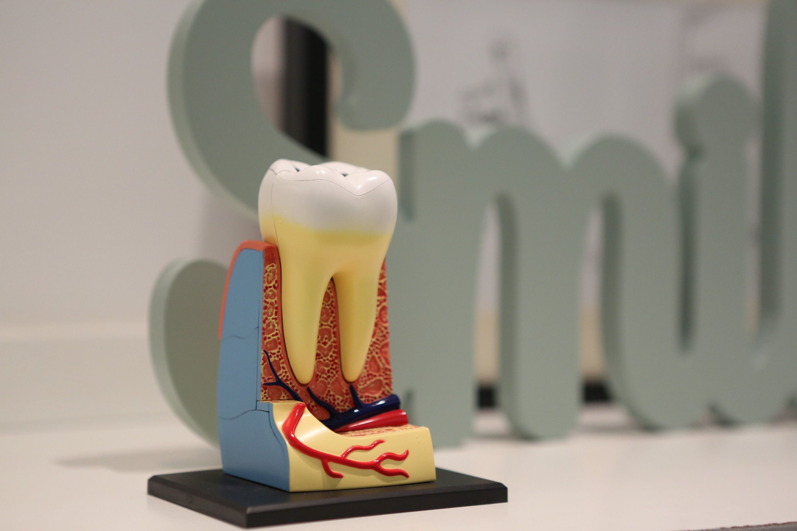 Dental model of a tooth showing the crown and roots